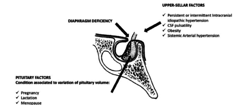 Etx Pit New Ch26 Fig1 Endotext 2045